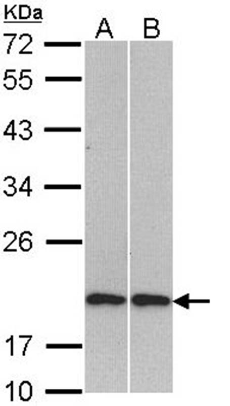 Cofilin 2 antibody