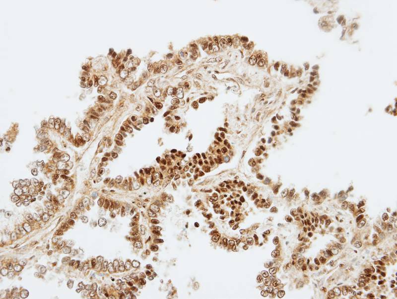 ZNF306 antibody
