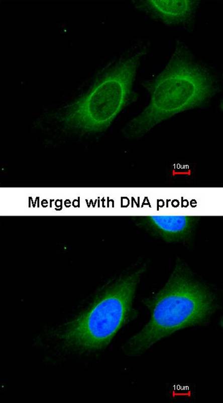 15-PGDH antibody