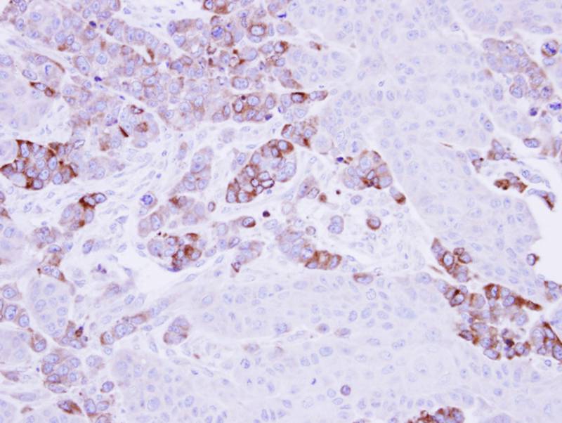 Epoxide hydrolase 1 antibody