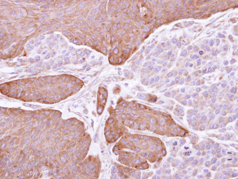Epoxide hydrolase 1 antibody