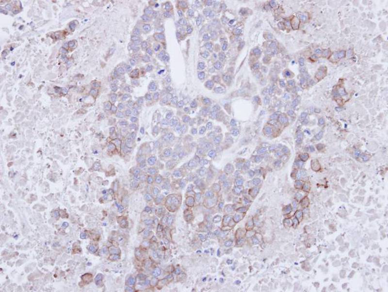 CD272 antibody