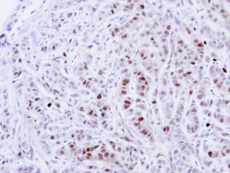 NEK4 antibody
