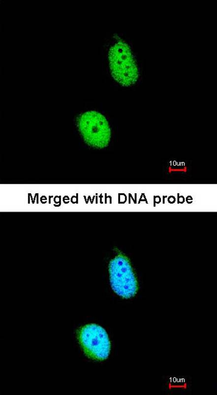 ERCC8(CSA) antibody