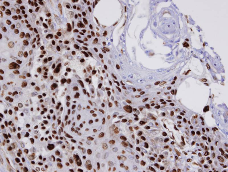 COUP-TFI antibody