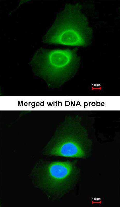 Cytochrome P450 4A11 antibody
