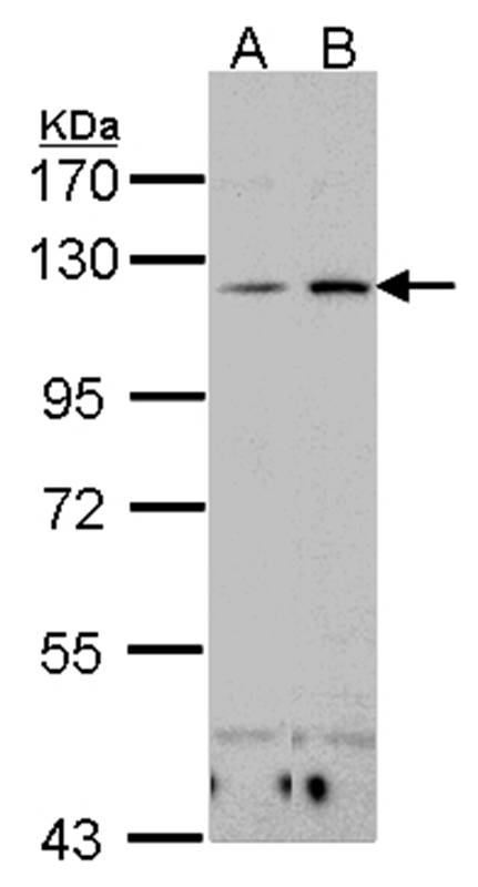 Integrin alphaX antibody