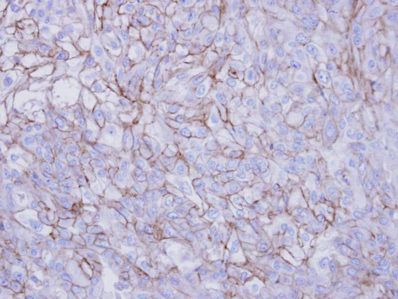 Desmoglein-2 antibody