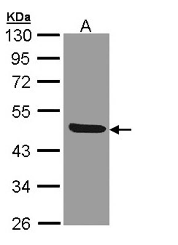 IL1R2 antibody