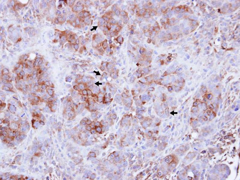 Guanylate-binding protein 3 antibody