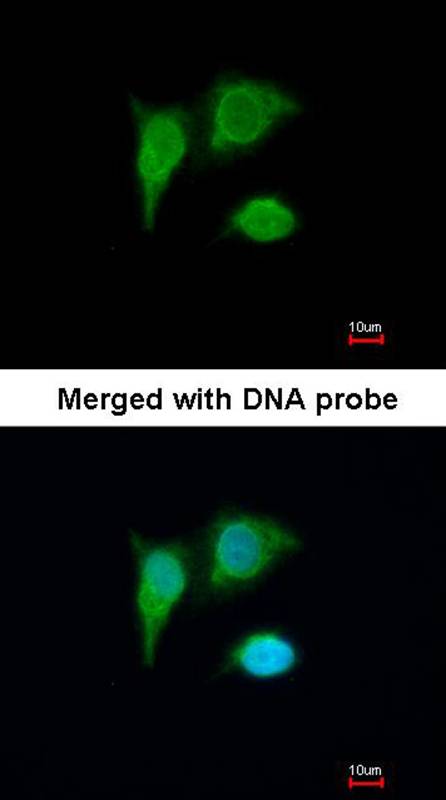 PIG3 antibody