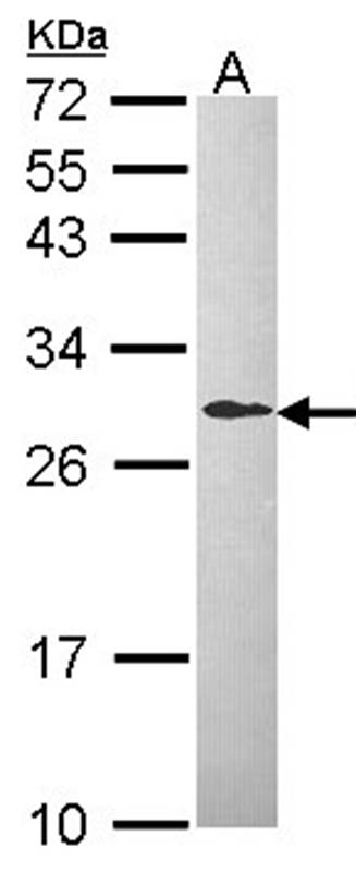 L-xylulose reductase antibody