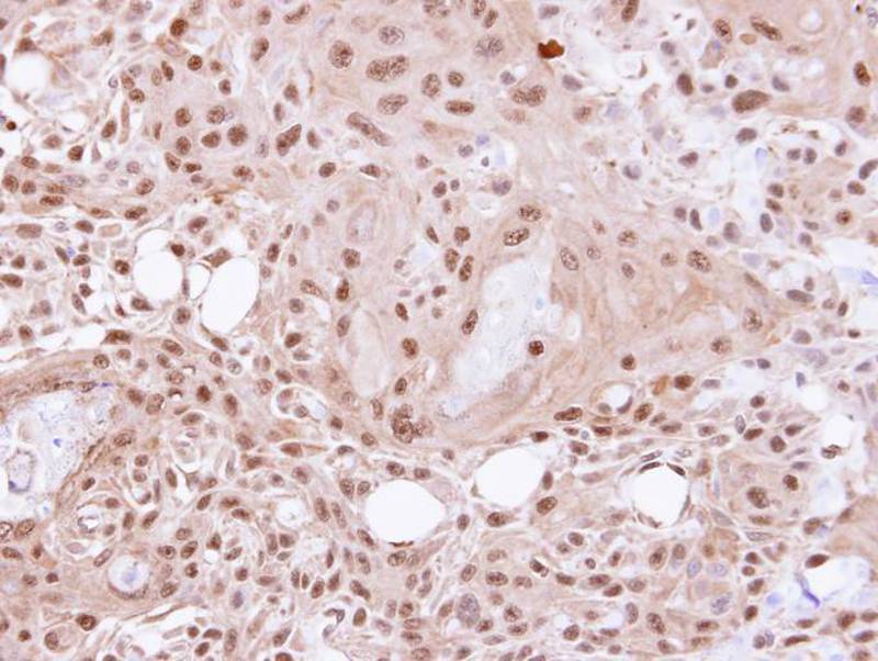VCP(p97) antibody