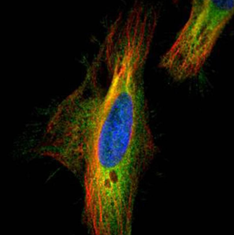 Dia 1 antibody