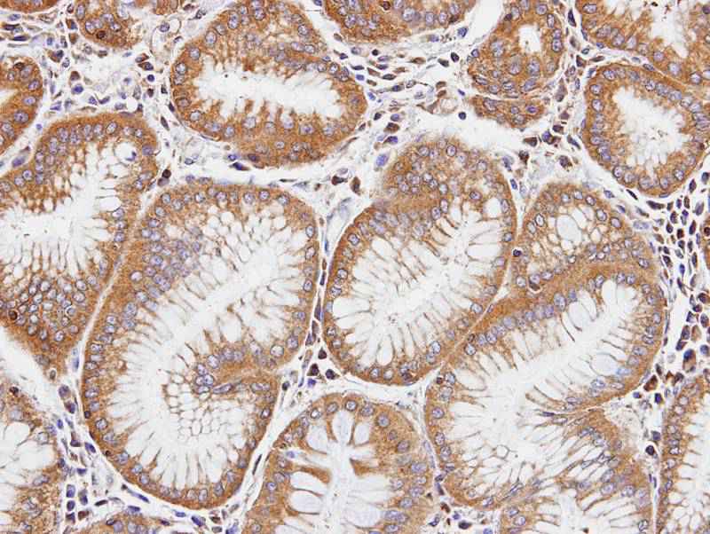 Dia 1 antibody