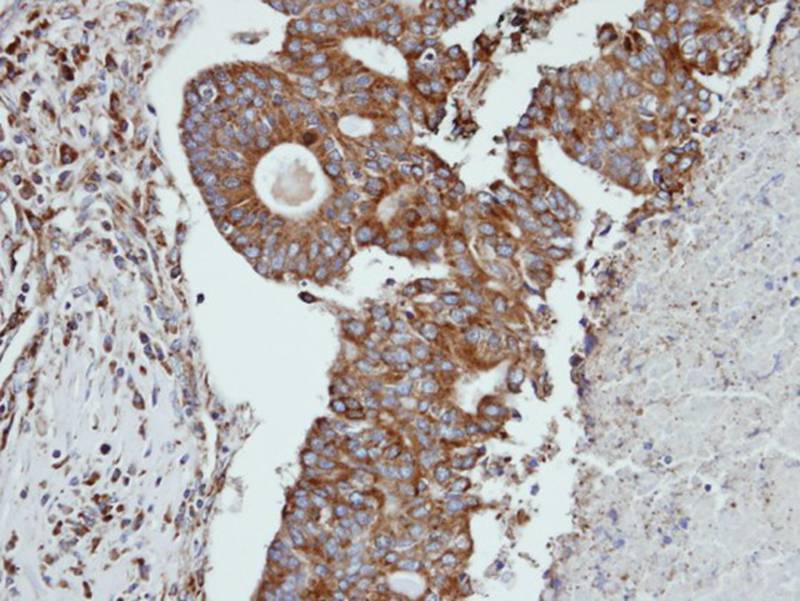 Cathepsin S antibody