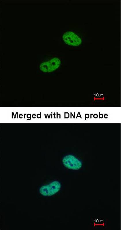 WT1 antibody
