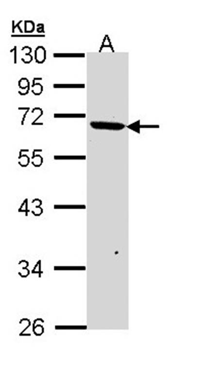 PSR antibody