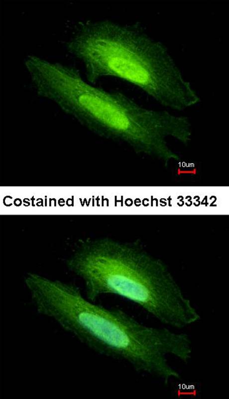 PDE6D antibody