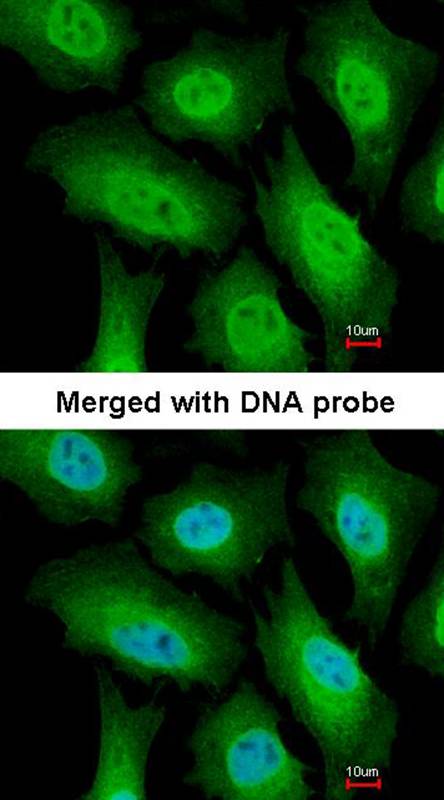 FACA antibody