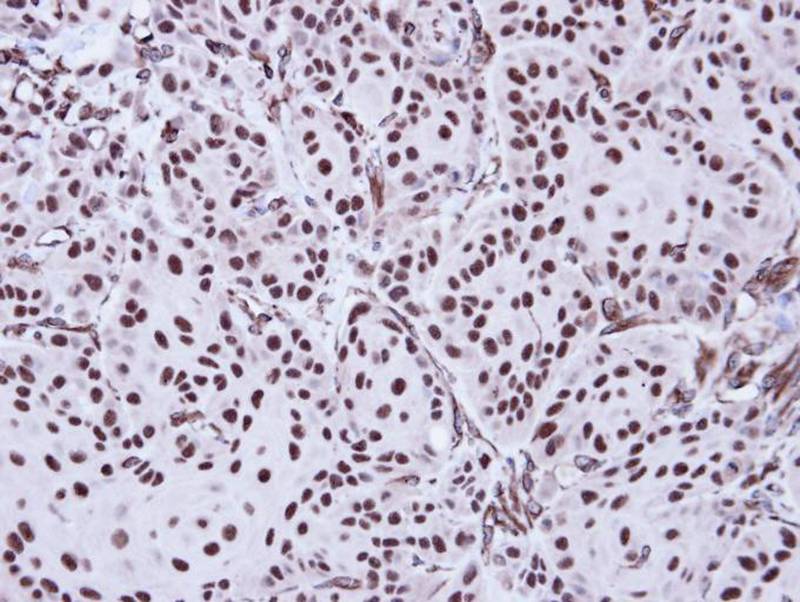 Apoptosis-enhancing nuclease antibody