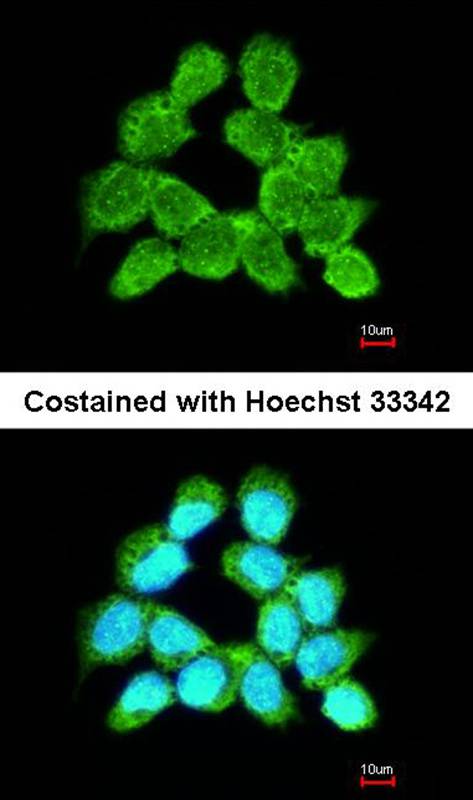 LARS2 antibody