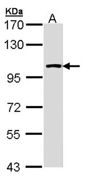 LARS2 antibody