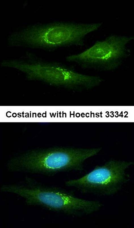 SERPINB6 antibody