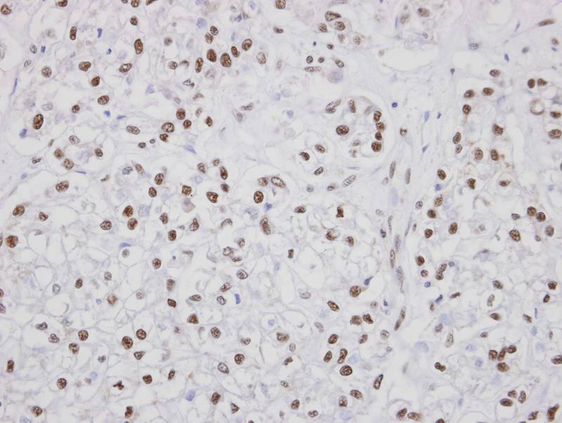 PUF60 antibody