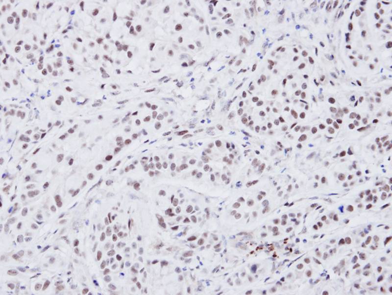 ATRX antibody