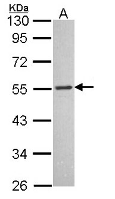 MCH-1R antibody