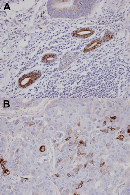 AKAP10 antibody
