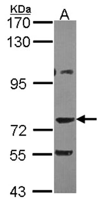 AKAP10 antibody