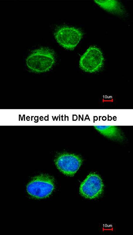 AKR7 antibody