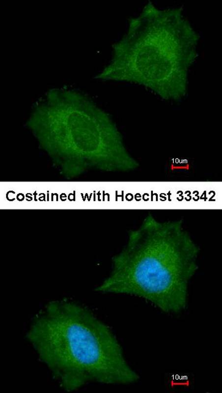 Aspartoacylase antibody