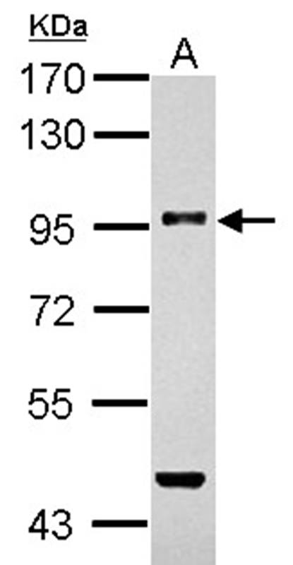 TGF beta Receptor III antibody