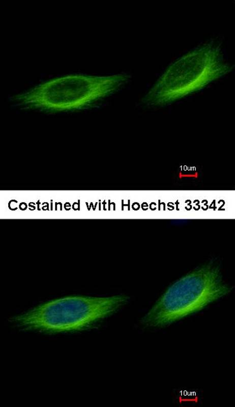 Tubby-related protein 1 antibody