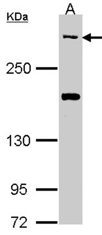 CACNA1B antibody