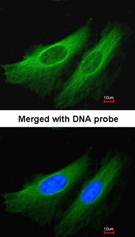 HL antibody