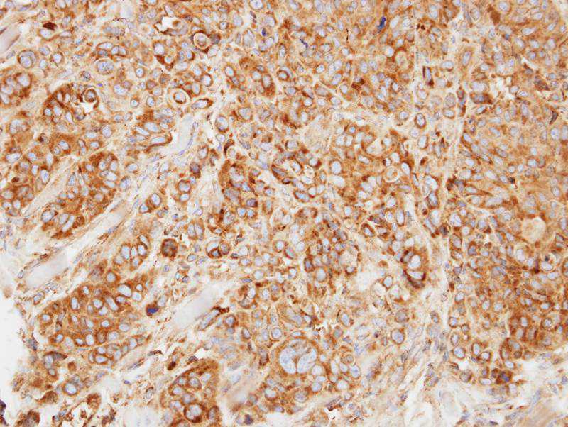 HL antibody