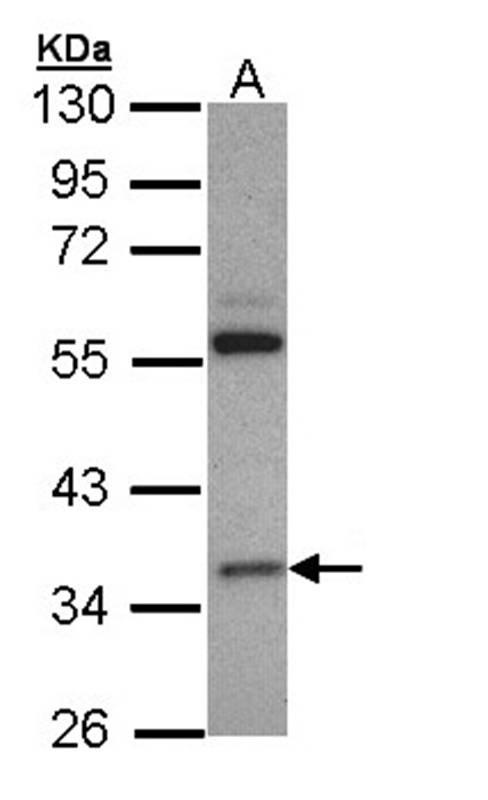 HL antibody