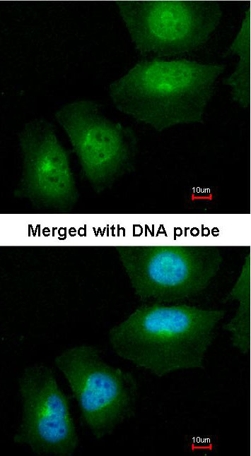 S100A11 antibody