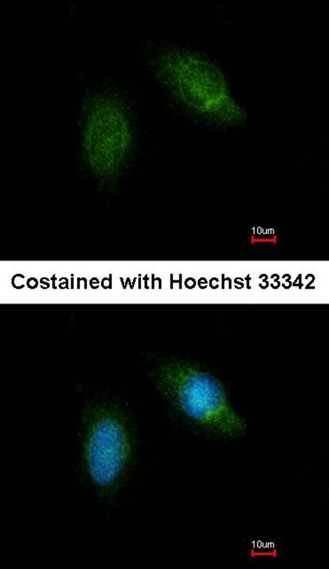 Calpain 5 antibody