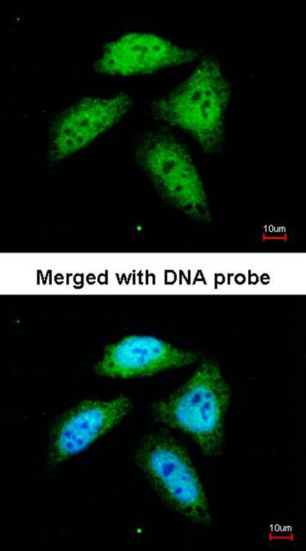 CTBP1 antibody