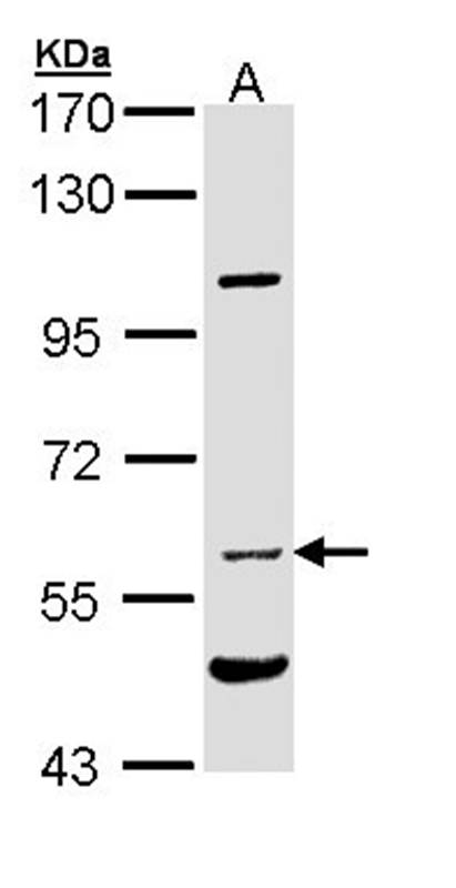 NPR-C antibody