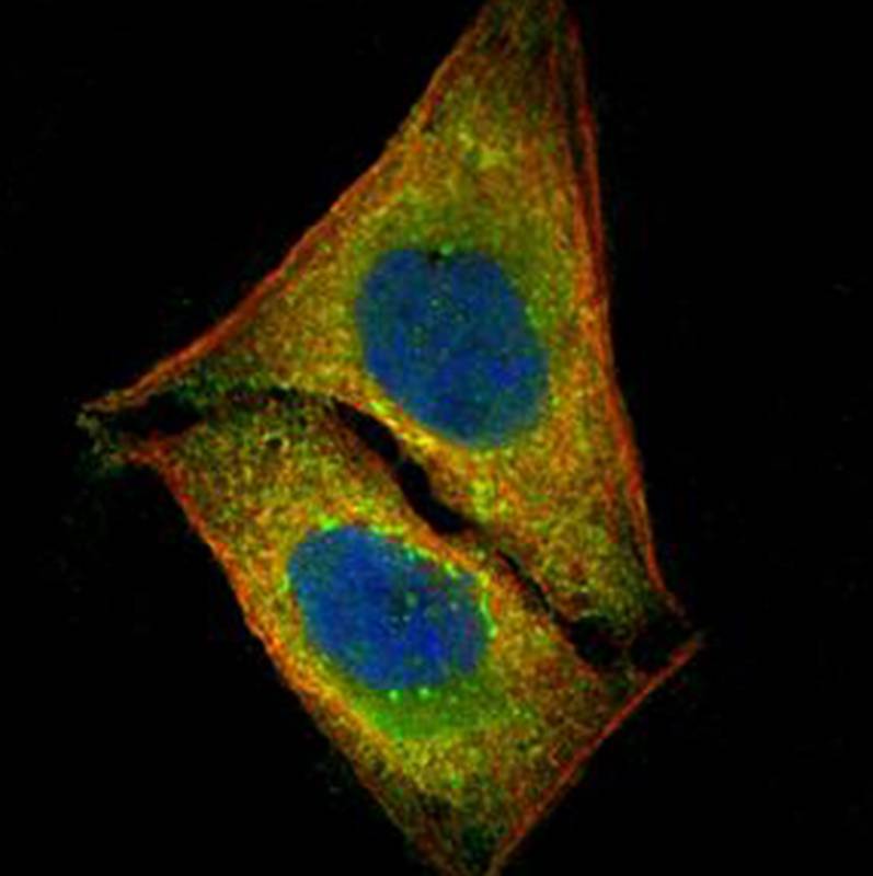 MST1 antibody