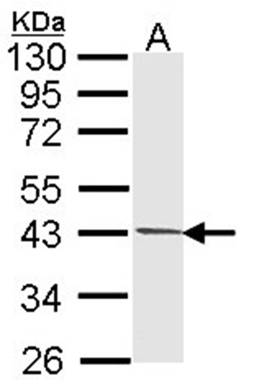 PIM2 antibody