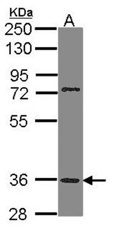 PNR antibody
