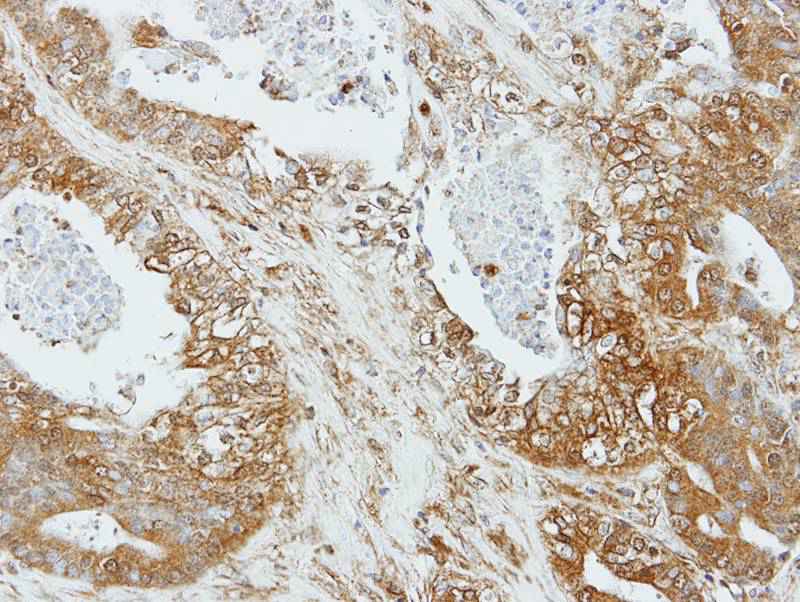 Apelin receptor antibody