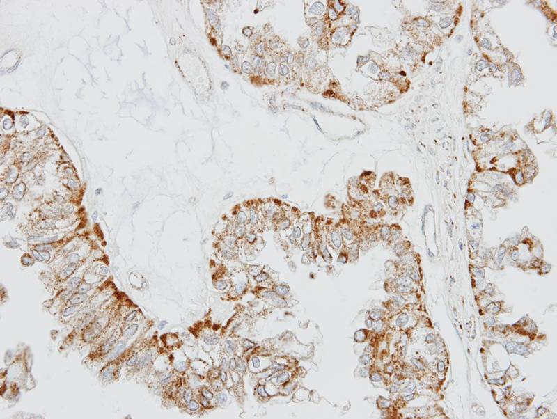 GPR 164 antibody